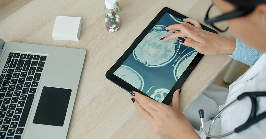 A doctor viewing a brain scan on a tablet.